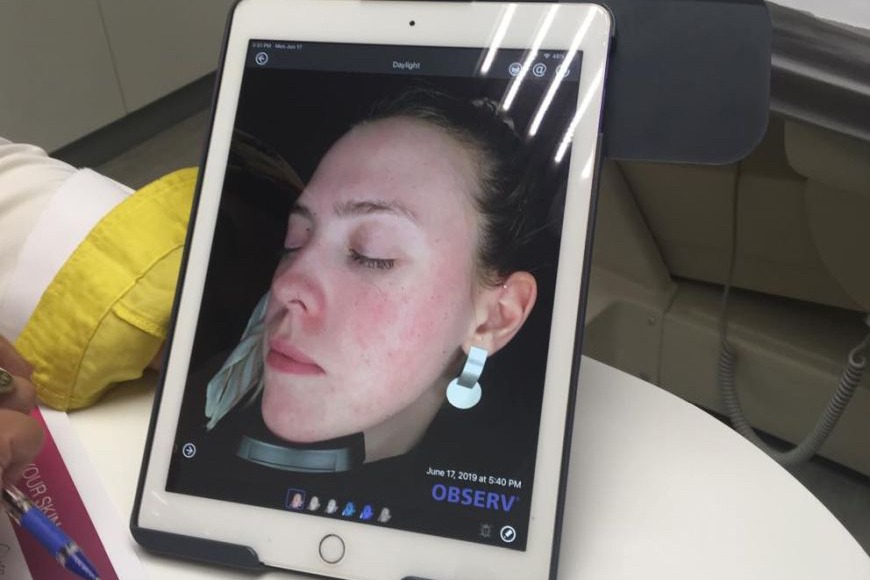 Review: Skin Cell Activation at Kaya Skin Clinic Review: Skin Cell Activation at Kaya Skin Clinic